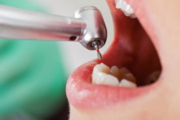 Best Cosmetic Emergency Dentistry in Beckley, WV